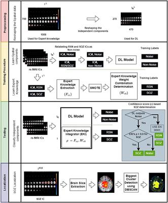 The expert's knowledge combined with AI outperforms AI alone in seizure onset zone localization using resting state fMRI